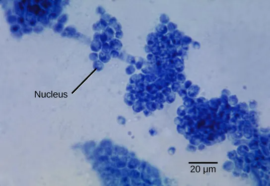 Micrograph shows clumps of small blue spheres. Each sphere is about 5 microns across.