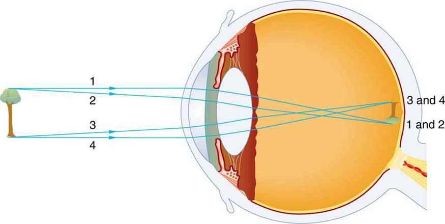 Ray diagram in the picture shows the internal structure of an eye and a tree that is taken as an object. An inverted image of the tree is formed on retina with the light rays coming from the top and bottom of the tree; converging most at the cornea and upon entering and exiting the lens. The rays coming from top of the tree are labeled one, two, while the bottom rays are labeled three, four. The inverted image of the tree shows rays labeled three, four at the top and one, two at the bottom.