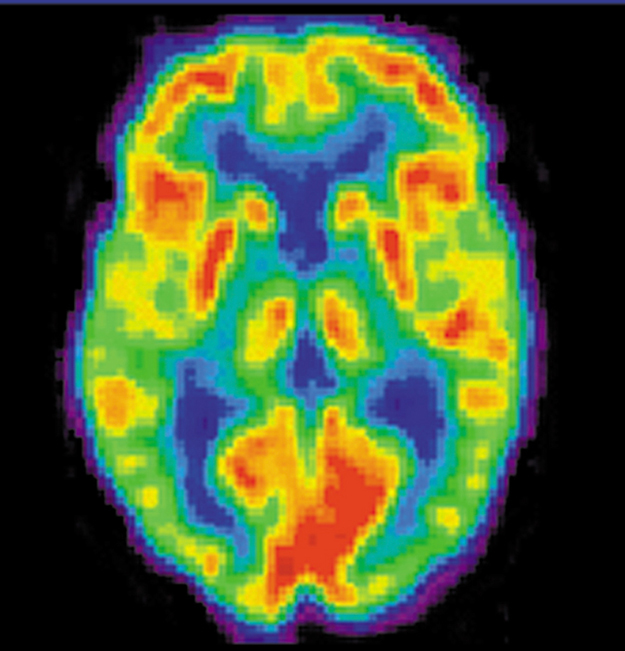 32.1 Medical Imaging and Diagnostics – College Physics